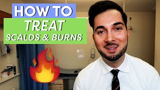 Burns  How To Treat Burns  How To Treat A Burn [upl. by Llednohs]