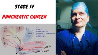 Chasing Metastatic Cancer Cells [upl. by Ataynek]