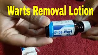 Wart Removal Lotion [upl. by Hugibert776]