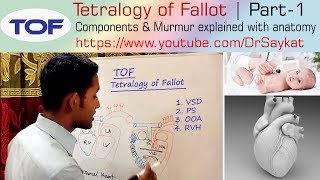 Fetal echocardiography at 1113 weeks Tetralogy of Fallot TOF [upl. by Etiragram]