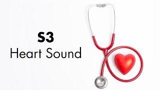 S3 Heart Sound  MEDZCOOL [upl. by Burg]