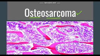 Osteosarcoma GeneralMorphology SubtypesClinical features [upl. by Nelg]