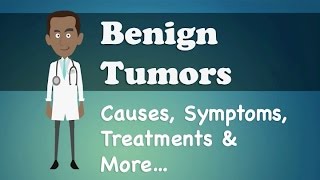 Benign Tumor Vs Malignant Tumor  Clear Comparison [upl. by Inatsed]