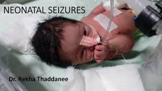 Neonatal Seizures  Pediatrics [upl. by Nna291]