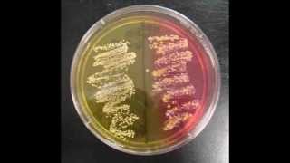 Mannitol Salt Agar MSA Bacterial Growth Medium Microbiology Lab Tutorial [upl. by Allac]