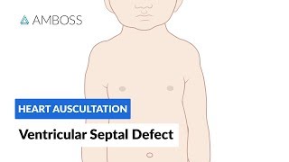 Ventricular Septal Defect VSD  Heart Auscultation  Episode 11 [upl. by Aimee223]