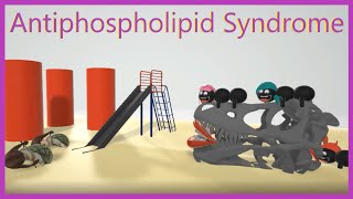 Antiphospholipid Syndrome Mnemonic for the USMLE [upl. by Vinita]