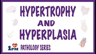 Hypertrophy and Hyperplasia [upl. by Ailam787]