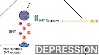 Major Depression and SSRIsSNRIs [upl. by Wylie]