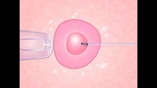 Fertilização in vitro O Passo a Passo [upl. by Enaz]