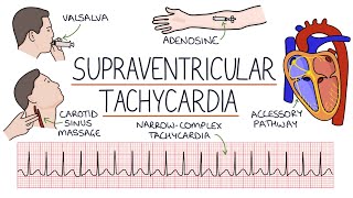 CCRN Review Cardiology  FULL [upl. by Tifanie414]