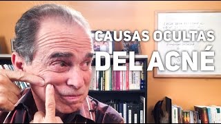 Episodio 1149 Causas Ocultas Del Acné [upl. by Ettezus888]