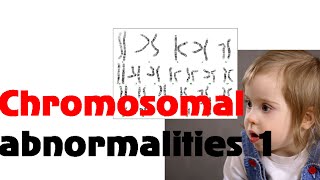 Chromosomal abnormalities 1 [upl. by Bunce]