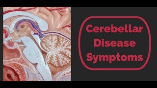 Cerebellar Disease Symptoms [upl. by Florence]