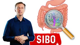 Small Intestinal Bacterial OvergrowthSIBO Steals Your Nutrients – DrBerg [upl. by Aleacin]