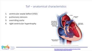 Tetralogy of Fallot Repair [upl. by Aihsenyt]