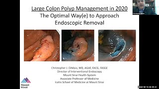 Large Colon Polyp Management in 2020 The Optimal Waye to Approach Endoscopic Removal [upl. by Car]