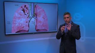 Effects of Tuberculosis on Lungs [upl. by Johnathon]