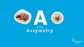 Approach to a Thyroid Nodule  causes investigation and treatment [upl. by Adniles]