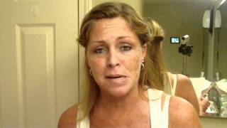 Skin Cancer My Vlog Journal Treatment W EFUDEX vid5 [upl. by Llekcir]