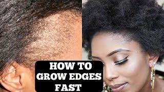 HOW TO GROW YOUR THINBALD EDGES IN 3 DAYS GUARANTEED [upl. by Nalliuq]