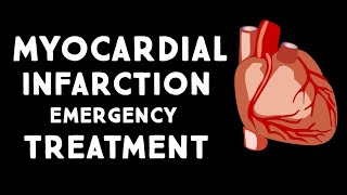 Myocardial Infarction MIHeart Attack Treatment in Emergency  Step wise STEMI Management USMLE [upl. by Alcock]