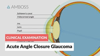 ophthalmoscopy video [upl. by Sirromal]