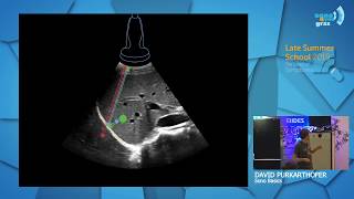 Sono Basics  Grundlagen der fokussierten Sonographie  David Purkarthofer  Late Summer School 2019 [upl. by Odrautse570]