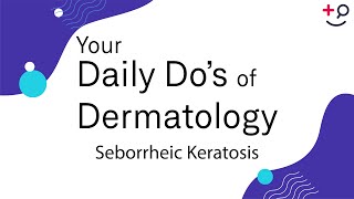 Seborrheic Keratosis  Daily Dos of Dermatology [upl. by Onnem88]