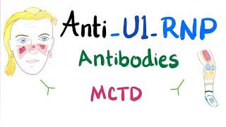 AntiU1Ribonucleoprotein AntiU1RNP autoantibodies [upl. by Sik]