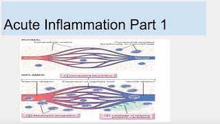 Acute Inflammation Part 1 [upl. by Sisxela]