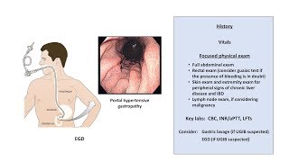 An Approach to GI Bleeding Melena Hematemesis Hematochezia [upl. by Boigie]