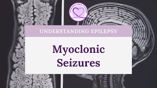 What are Myoclonic Seizures [upl. by Turrell]