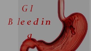 GI Bleed Upper GIT Bleeding Part 1 [upl. by Elrahc]