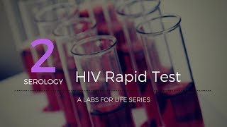 HIV Rapid Test [upl. by Brandenburg]