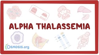 Alphathalassemia  an Osmosis Preview [upl. by Bakeman]