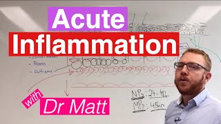 Acute Inflammation  Immunology [upl. by Haeel]