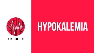 Hypokalemia  an easy workup [upl. by Virgina]