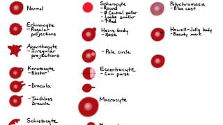 RBC Morphology [upl. by Oiromed287]