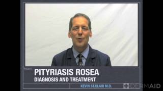 Pityriasis Rosea [upl. by Minsat]