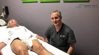 Laser Skin Tightening Video [upl. by Gower]