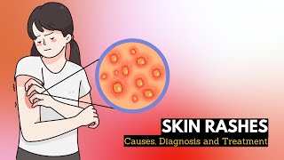 Skin Rash Causes Signs and Symptoms Diagnosis and Treatment [upl. by Kira]