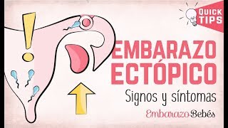 EMBARAZO ECTÓPICO 💔😭 Signos y síntomas [upl. by Notnil]