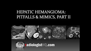 Hepatic Hemangioma Pitfalls amp Mimics Part II [upl. by Ssew117]