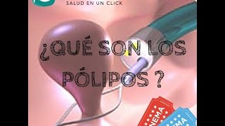 ¿Qué son los Pólipos [upl. by Burdelle]