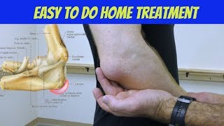 Elbow Bursitis Treatment at Home  How to Treat Olecranon Bursitis [upl. by Huei]