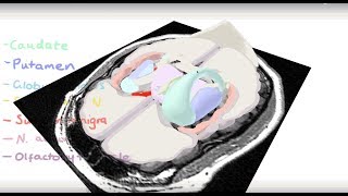 Basal Ganglia 3D Tour [upl. by Yodlem427]