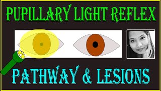 Pupillary Light Reflex – Pathway amp Lesions  Neuro ophthalmology [upl. by Itsrejk641]