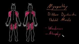 Myelopathy  Patient Education [upl. by Laine]