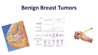 Breast ScreeningImaging for Cancer BIRADS Interpretation [upl. by Cordey]